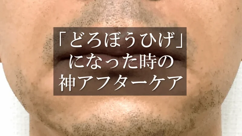 dorobouhige