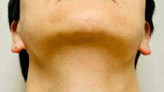 Thumbnail of post image 057