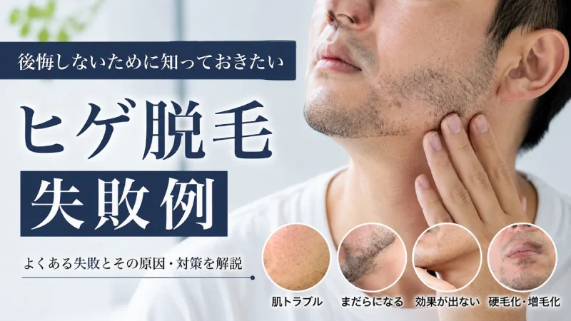 ヒゲ脱毛 失敗例