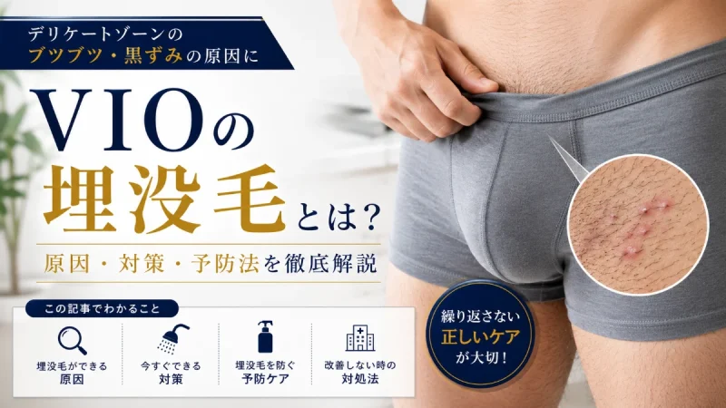 VIO 埋没毛