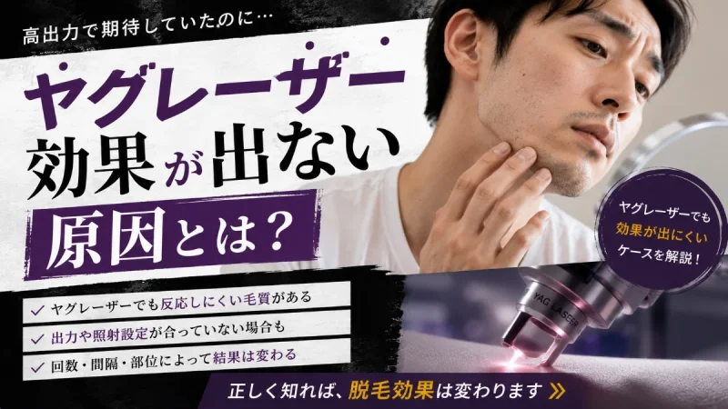 髭脱毛 ヤグレーザー 効果ない