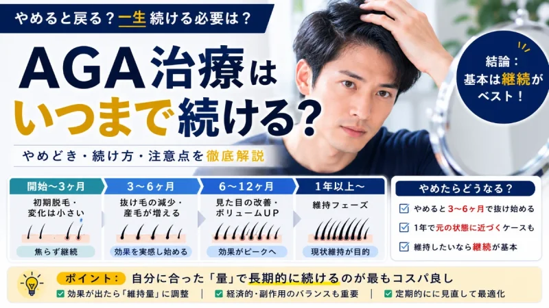 AGA治療 いつまで続ける