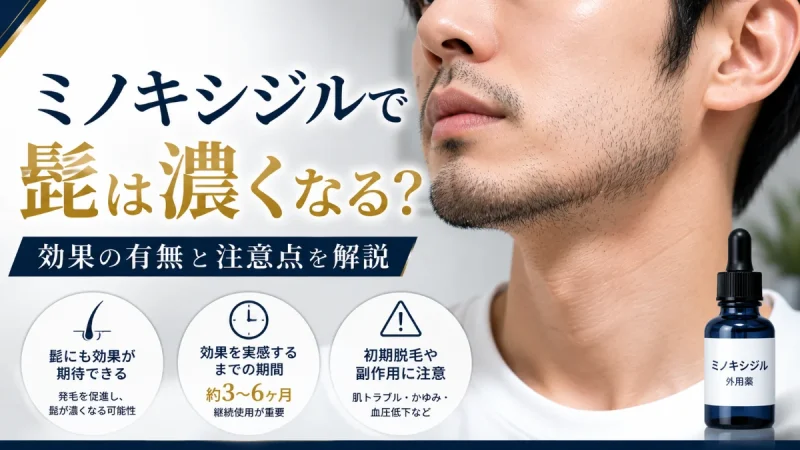 ミノキシジル 髭 濃くなる