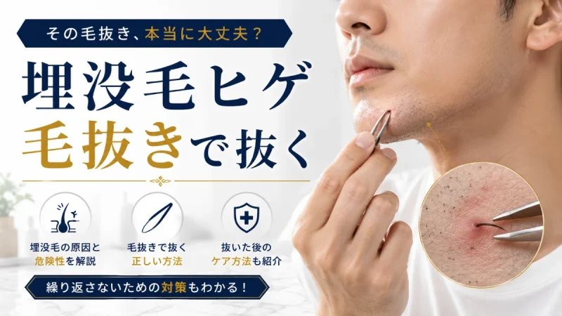 埋没毛 ヒゲ 毛抜きで抜く