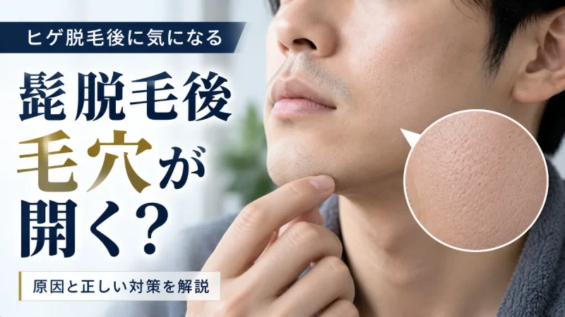 髭脱毛後 毛穴が開く