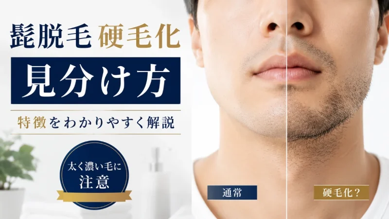 髭脱毛 硬毛化 見分け方